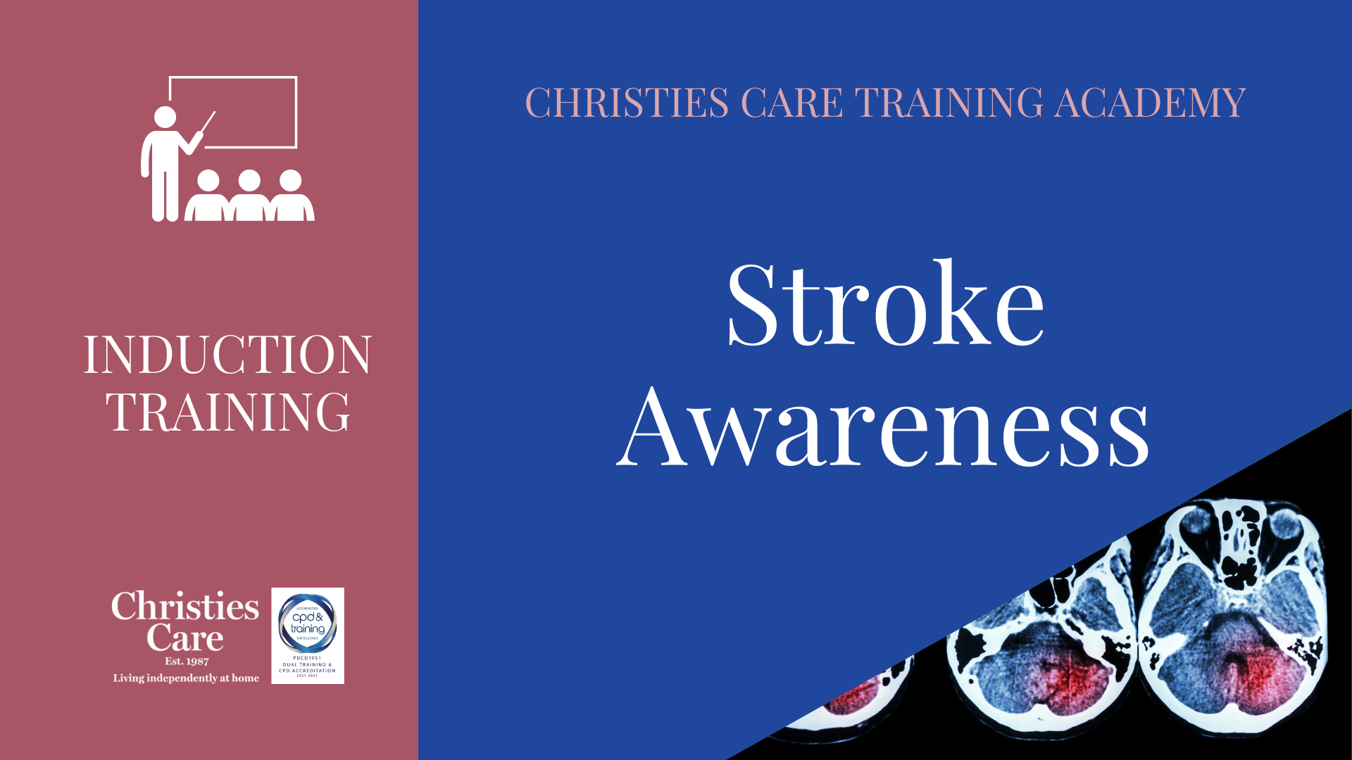 STROKE AWARENESS TR089